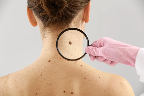https://www.karmamedicalcenter.it/wp-content/uploads/2022/09/500-dermatologia.jpg